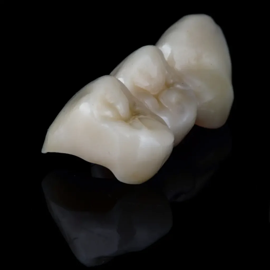 Broken-or-cracked-dental-bridge-Tucker-GA