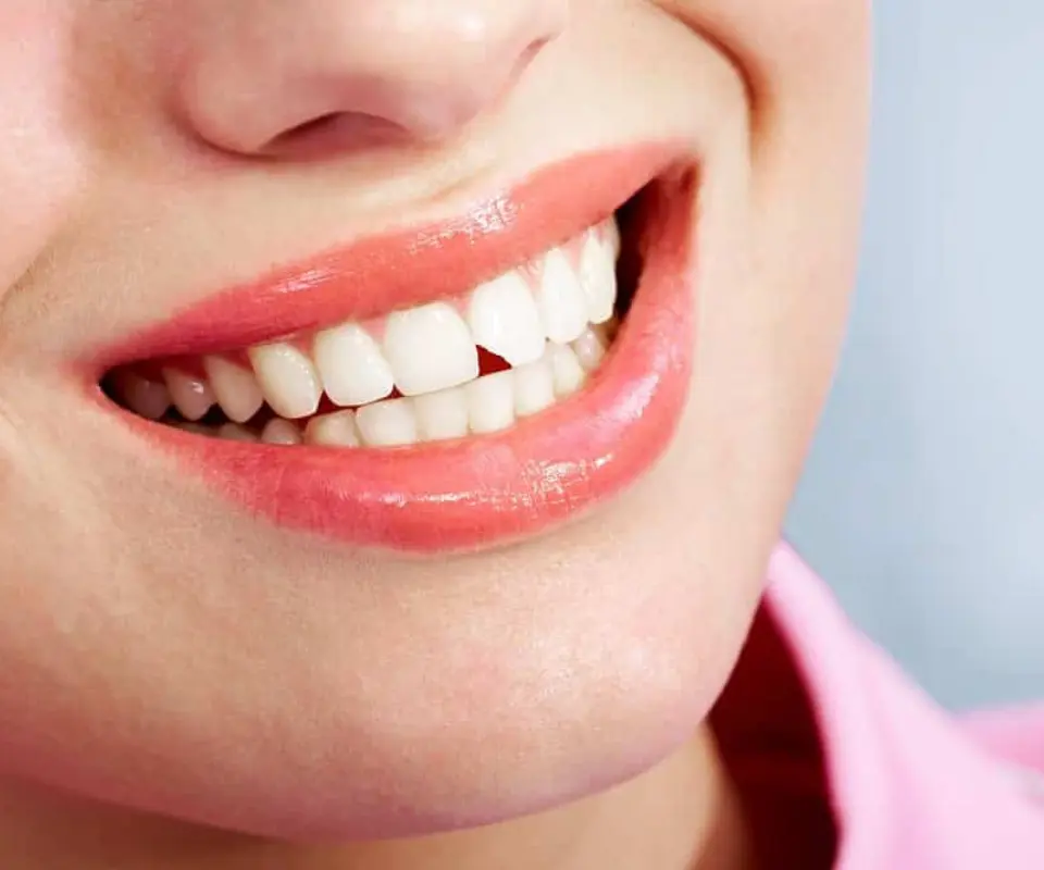 Chipped-Teeth-Tucker-GA