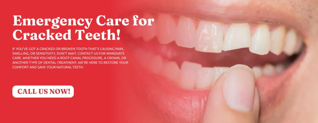 Cracked-Tooth-Repair-in-Tucker-GA