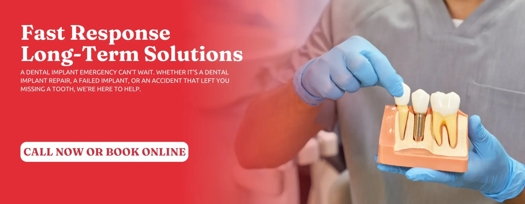 Dental-Implant-Solutions-Tucker-GA