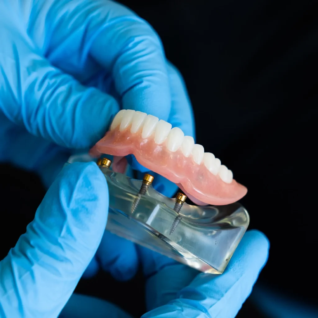 Emergency-Denture-Repairs-in-Tucker-GA