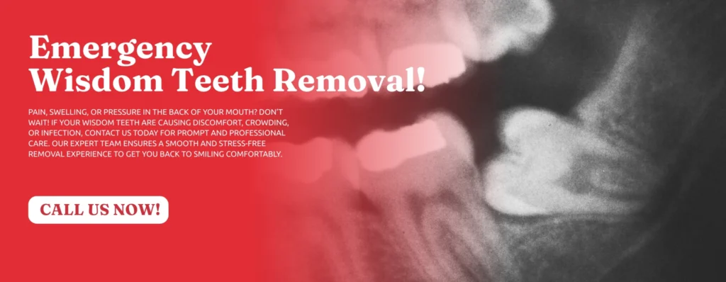 Emergency-Wisdom-Tooth-Removal-in-Tucker-GA