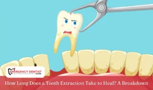 how-long-tooth-extraction-heal