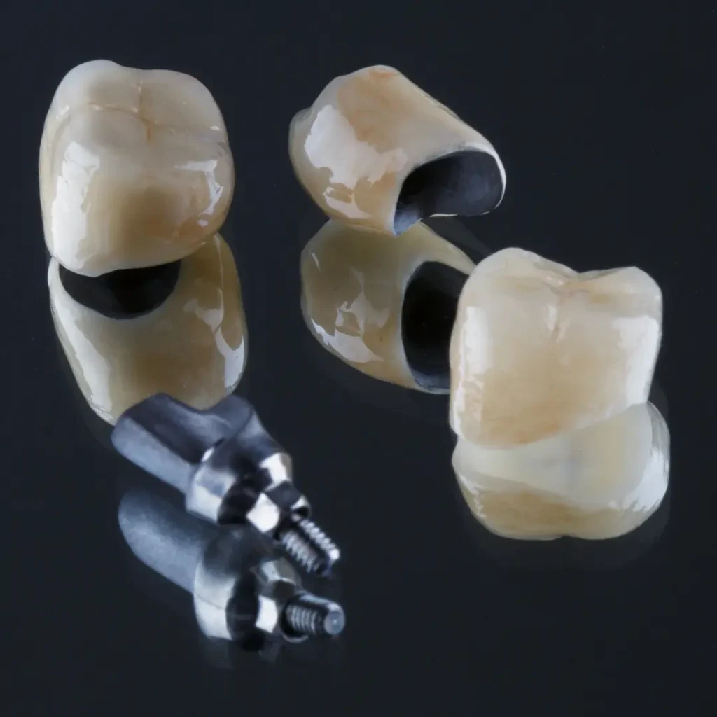 Loose-dental-bridge-or-crown-Tucker-GA