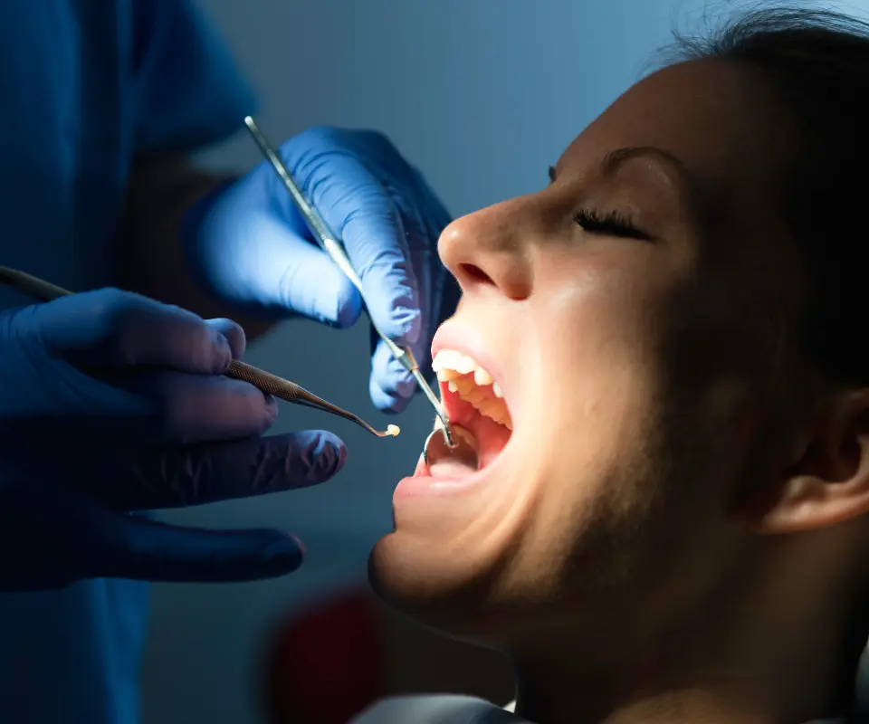 Lost-Fillings-or-Crowns-Tucker-GA