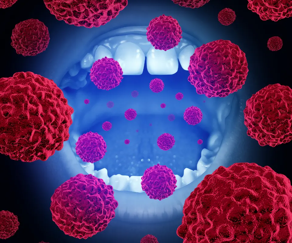 Oral-Cancer-Tucker-GA