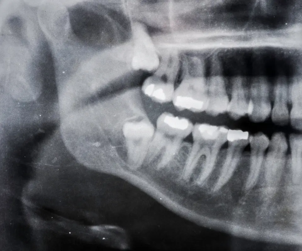 Quick-Exam-and-Xray-Tucker-GA