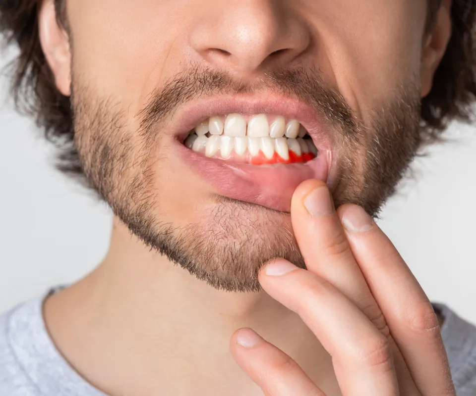 When-to-See-an-Emergency-Dentist-for-a-Tooth-Infection-Tucker-GA