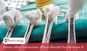 gauze-after-extraction-when-remove