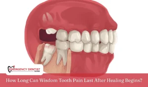 how-long-wisdom-tooth-pain-last-healing