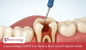 can-dentist-tell-if-you-need-root-canal-guide