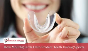 mouthguards-protect-teeth-during-sports