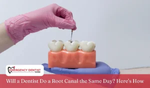 will-a-dentist-do-a-root-canal-the-same-day-heres-how